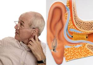 Hearing Loss after Cancer Treatment
