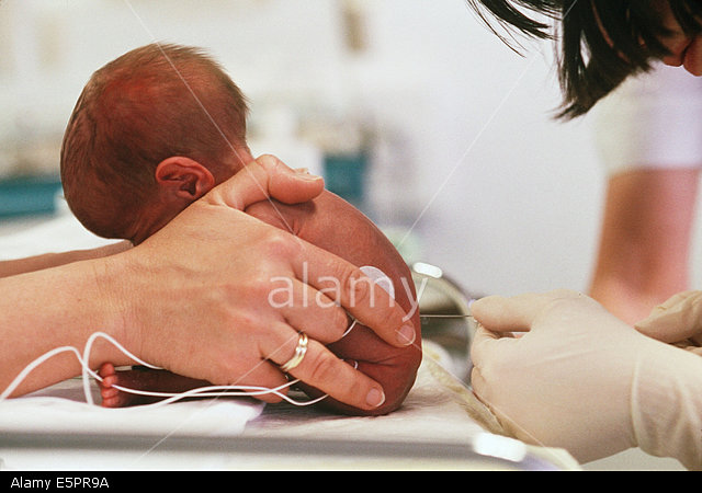 Lumbar Puncture in Premature Babies 