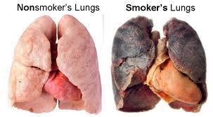 Smoker’s and Non-smoker’s Lung Cancer